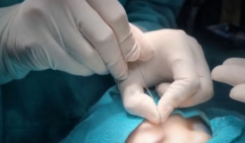 Çukurca Devlet Hastanesi’nde Gözyaşı Kanal Tıkanıklıklarına İleri Tedavi İmkanı